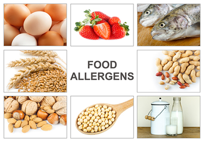 food-allergens-poster